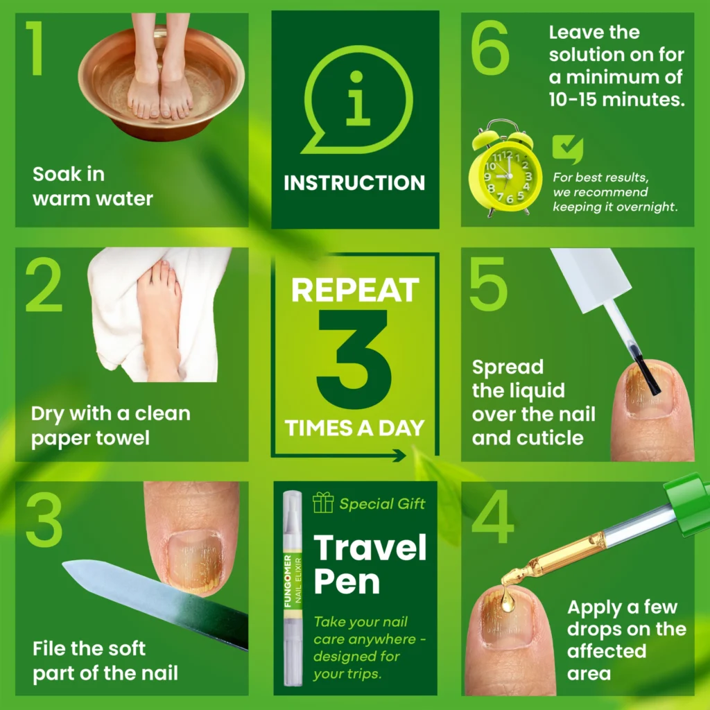 A set of instruction on how to use the Fungomer Nail Elixir to treat fungal nail